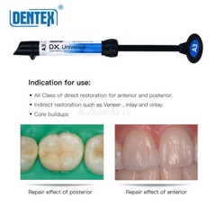 USPS DX Dental Universal Curing Light Composite Resin Shade A1 A2 A3 A3.5 B1